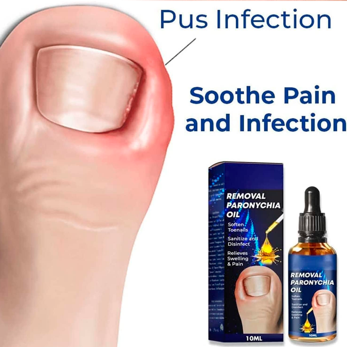 Aceite para Uñas Encarnadas, 10ml
