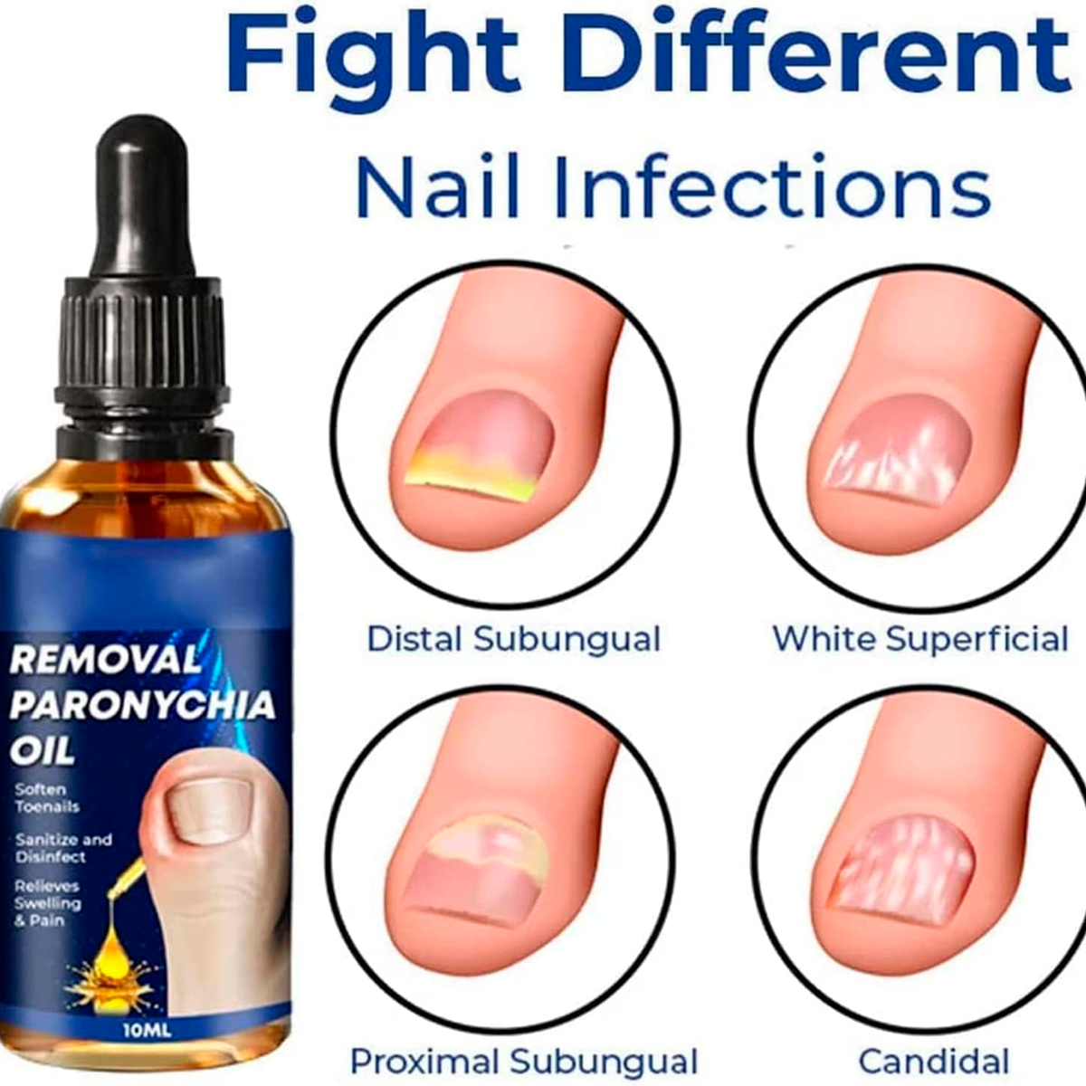 Aceite para Uñas Encarnadas, 10ml