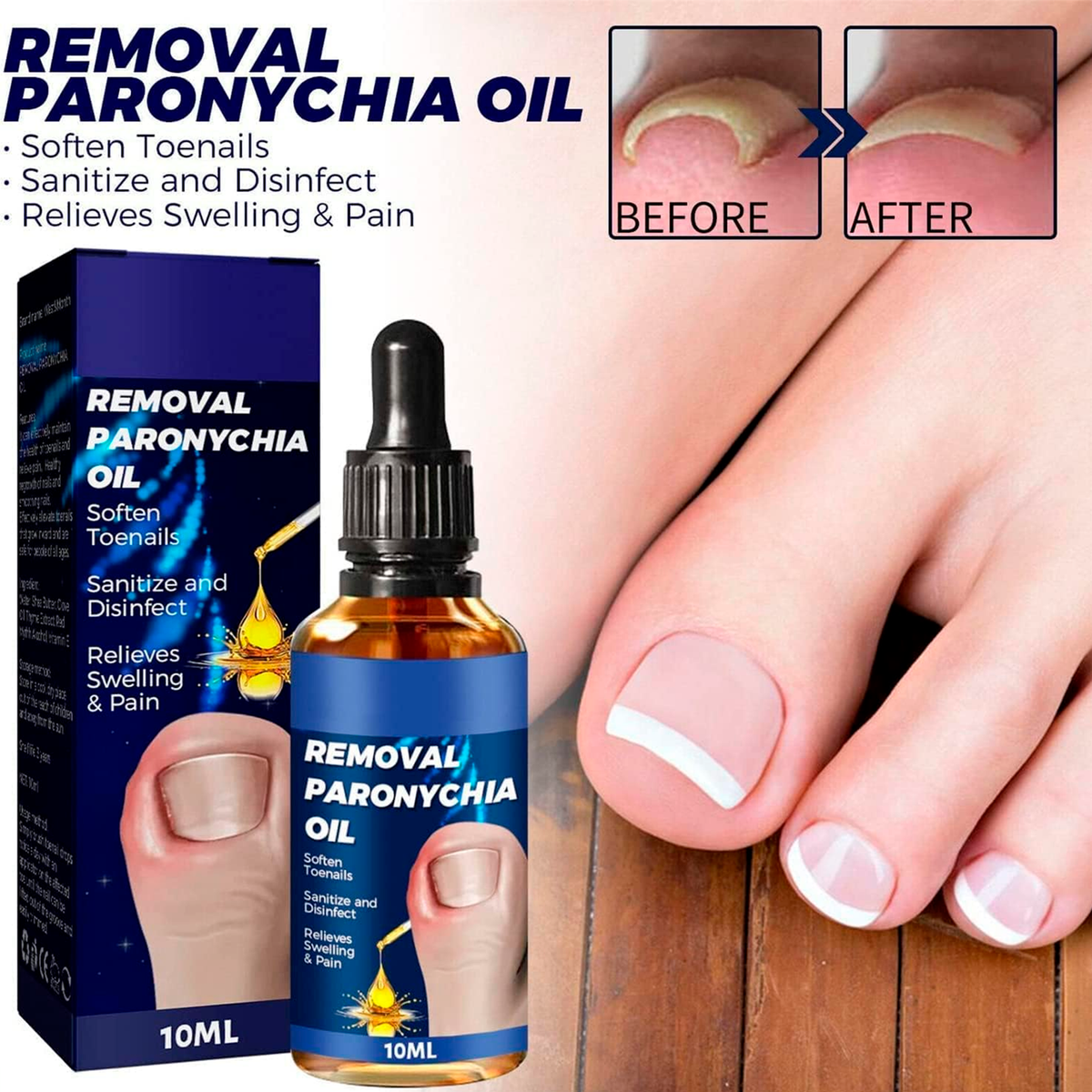 Aceite para Uñas Encarnadas, 10ml