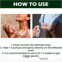 Spray Herbal para Hemorroides